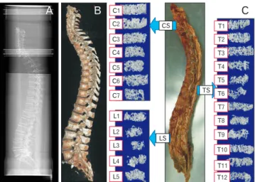 Fig. 2. (A) Spine in a water bath, registration of vertebral deformities  on the lateral image