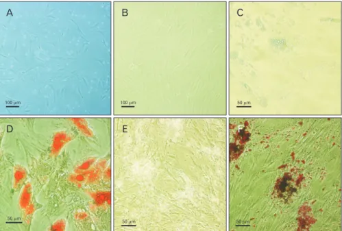 Fig. 2. hASCs isolation and differentiation  into osteoblasts and adipocytes. (A) P1 of  isolated hASC