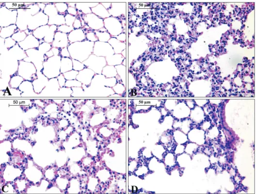 Fig. 4. Thin sections of 5 µm for  the lung of different experimental  groups in this study; (A) represents  the control group; (B) for WPS; (C)  for CUM+WPS; (D) for CAF+WPS