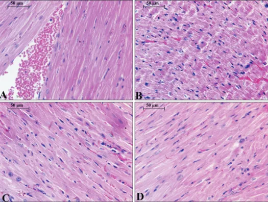 Fig. 5. Thin sections of 5 µm for  the heart of different experimental  groups in this study; (A) represents  the control group; (B) for WPS; (C)  for CUM+WPS; (D) for CAF+WPS