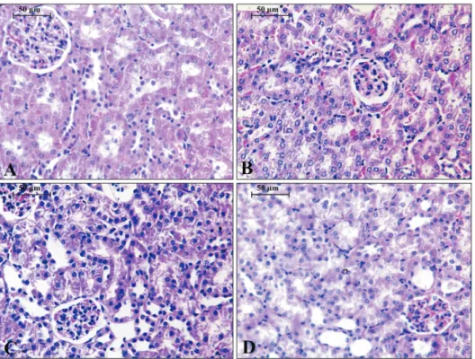 Fig. 6. Thin sections of 5 µm for the  kidney of different experimental groups  in this study; (A) represents the control  group; (B) for WPS; (C) for CUM+ 