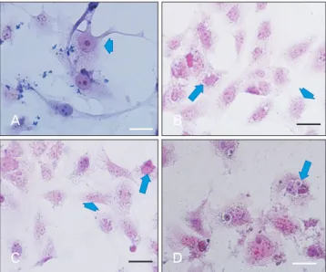 Fig. 4. H&amp;E staining of PTC cells. Control group without any  treatment (A). PTC cells under treatment with HLPS with the dose  of 800 µg/ml (B), and 1,600 µg/ml (C)