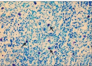 Fig. 1. Photomicrograph of toluidine blue stained section showing  mast cells in the human oral mucosal connective tissue (40×).