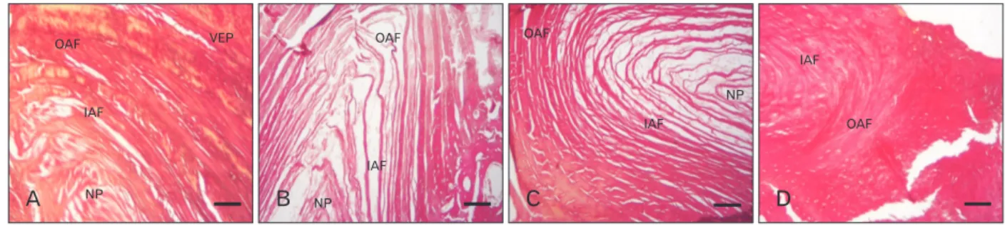 Fig. 5. (A) Photomicrograph of IVD collagen fibers organization in control rabbit showing parallel arrangements of collagen fibres in AF