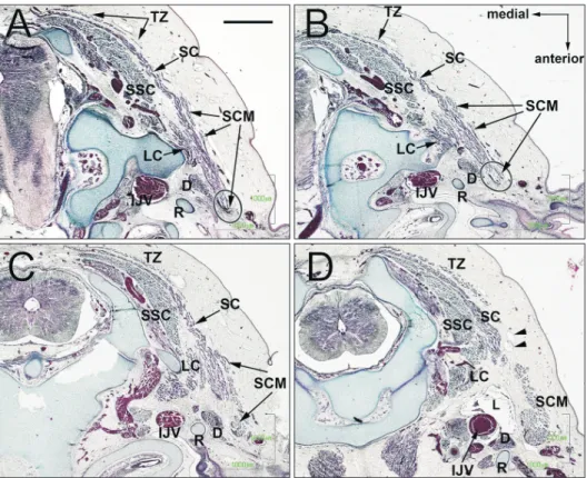 Fig. 6. Schematic representations of the muscle splitting. Growing  of the splenius capitis muscle might allow a single mesenchymal  condensation of the SCM and trapezius muscles to divide