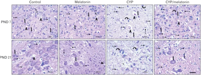 Fig. 1. Representative H&amp;E staining of rat medulla oblongata of control and melatonin aged 7 days: showing medulla neurons appeared small in  size, varied in shape and had round nuclei (black arrows)