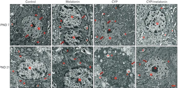 Fig. 3. An electron micrograph of a section in control and melatonin rat medulla oblongata aged 7 days shows motor neurons having rounded  euchromatic N with regular nuclear membranes (arrow) and prominent Nu