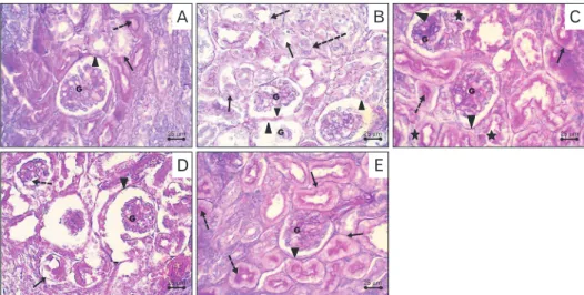 Fig. 3. Periodic acid–Schiff stained sections in the fetal kidney. (A) Control group showing positive stain in the glomeruli (G), Bowman’s  capsule (arrowhead), basement membrane of renal tubules (arrow) and the brush border of proximal tubules (dashed arr