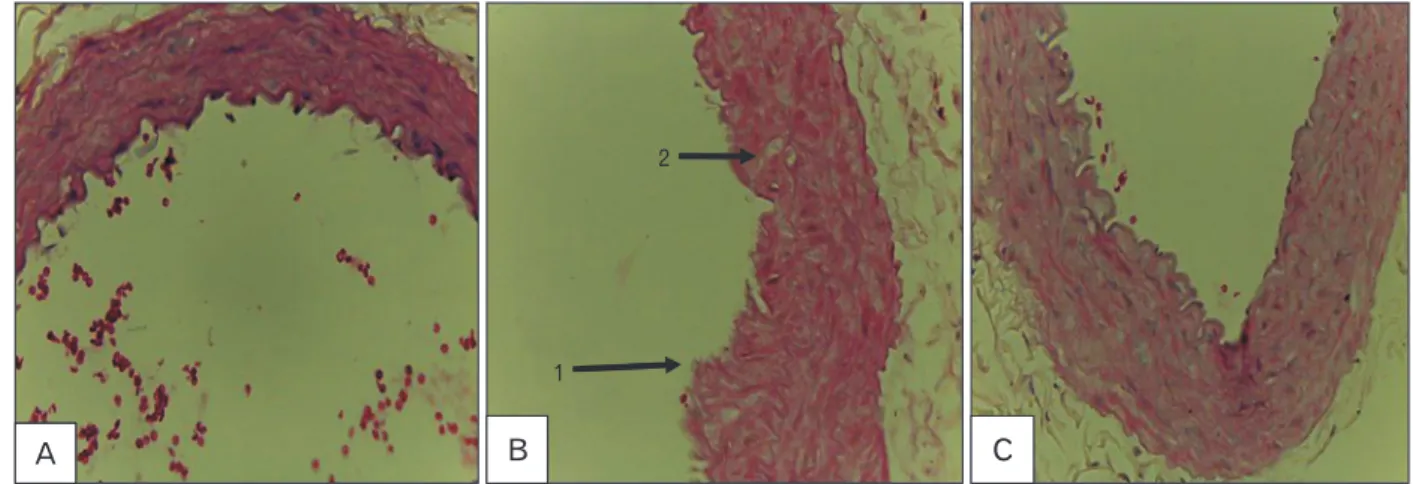 Table 1. Distribution of aortic atherosclerosis in the 3 groups