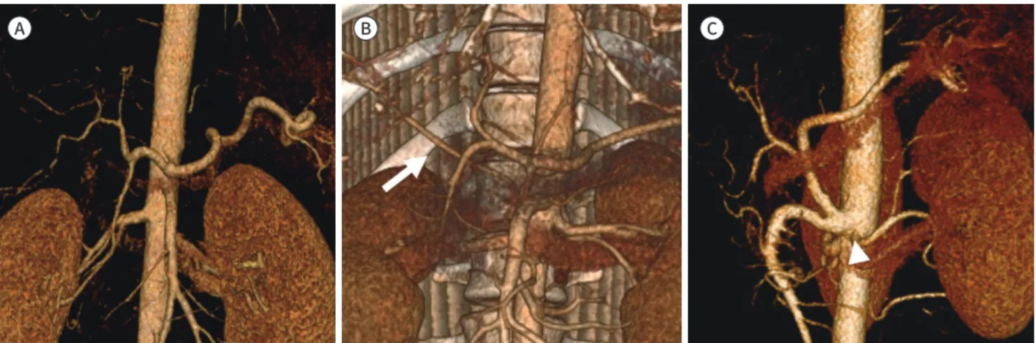 Fig. 4. Usual arterial anatomy and variations in CT angiography. 