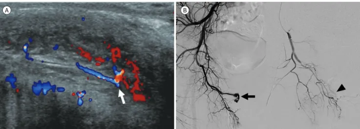 Fig. 8. Penile injury in a 35-year-old man who had a straddle accident. 