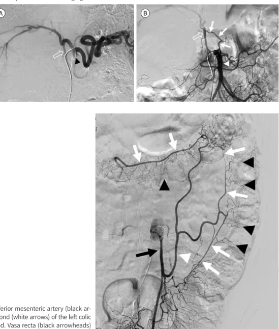 Fig. 11. Celiac trunk angiogram and superior mesenteric angiogram for transarterial chemoembolization in  a 42-year-old man.