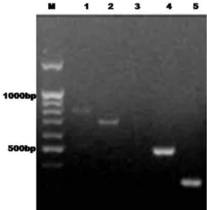 Fig. 4. PCR detection of genes for secondary metabolites produced by P. fluorescens. The oligonucleotide primers developed from sequences available in NCBI for respective genes of P