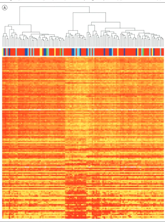 Fig. 1. Unsupervised hierarchical clustering analysis of the enrolled cases with differently expressed genes (A)  and differently extracted radiomic features (B)