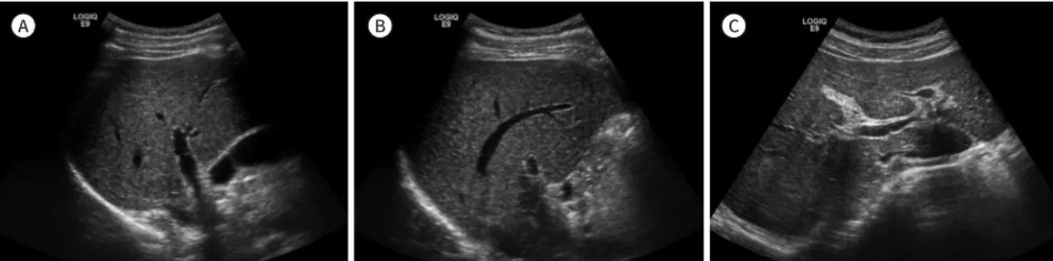 Fig. 2. Three additional standard views of the liver, gallbladder, bile duct, spleen, the pancreas to detailed ultrasound.