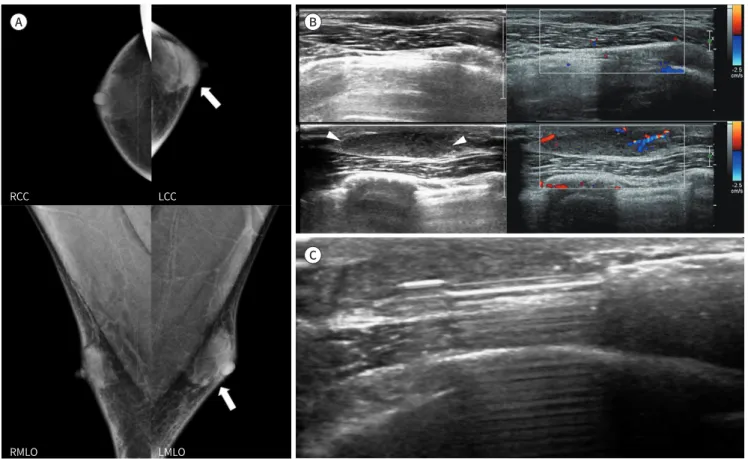 Fig. 1. A 34-year-old male with ADH. 