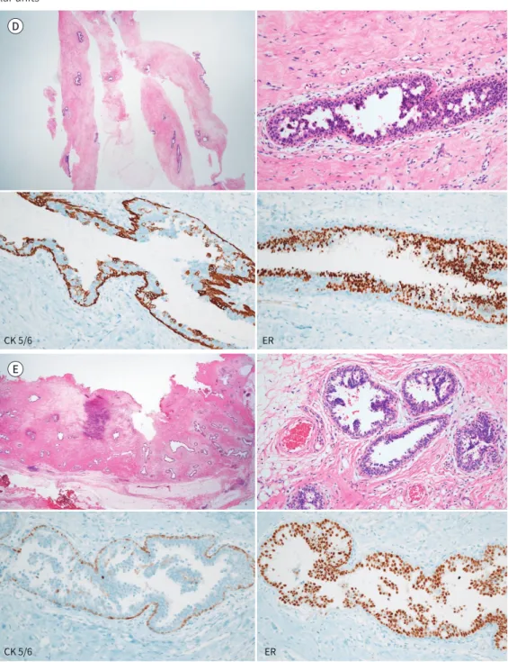 Fig. 1. A 34-year-old male with ADH. 