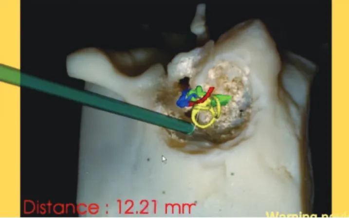 Fig. 4. Depth information is provided in  quantity at lower left corner, and  back-ground color (yellow) shows the level  of potential risk.