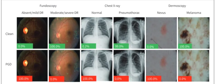 Fig. 3. Examples of quantitative results of an adversarial attack on medical image (36)