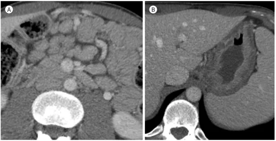 Fig. 13. Sarcoidosis in a 37-year-old man. 