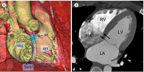 Fig. 12. Cardiac valves.
