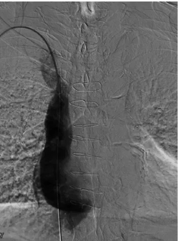 Table 1. Venography Findings
