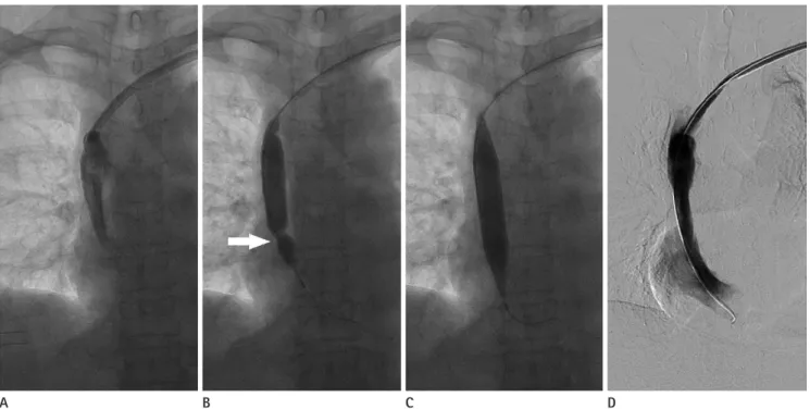 Fig. 3. A 51-year-old female.