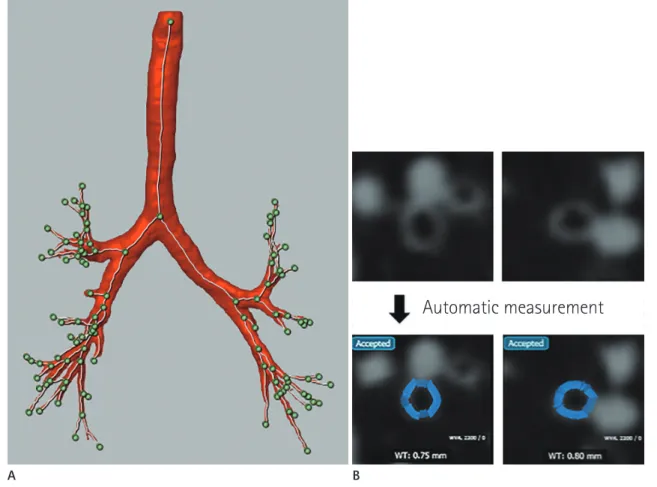 Fig. 2. Quantitative assessment of airways.