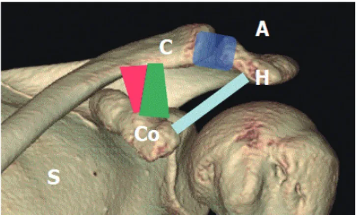Fig. 3. The normal anatomy of shoulder joint of a 20-year-old female. 