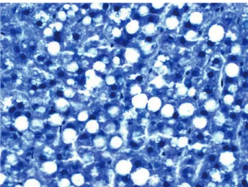 Table 2. The Number of Fatty Livers after High-Fat Diet in Rats