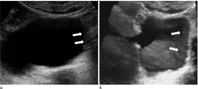 Fig. 7. Focal cystitis.