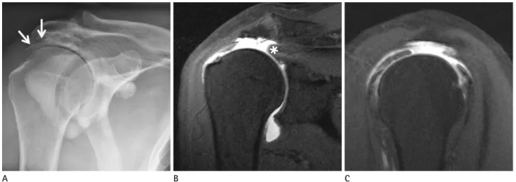 Fig. 1. A 75-year-old male patient in Group 1 (concordant group).