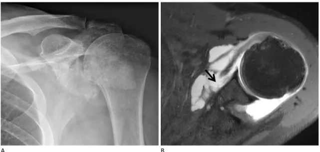 Fig. 3. A 62-year-old female patient in Group 2 (discordant group).