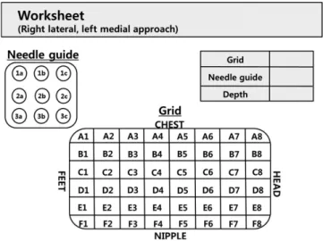 Fig. 3 shows the MRI-guided biopsy sequence. A precontrast  T1-weighted fat-saturation sequence is obtained to determine  whether the target lesion is within the grid