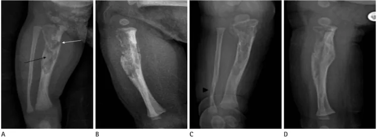 Fig. 1. Radiographs. 