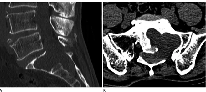 Fig. 2. Lumbar spine magnetic resonance imaging.