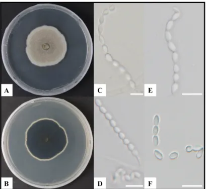 Fig. 1.  Cultural and morphological characteristics of Acrophialophora ellipsoidea KNU-US-1802E