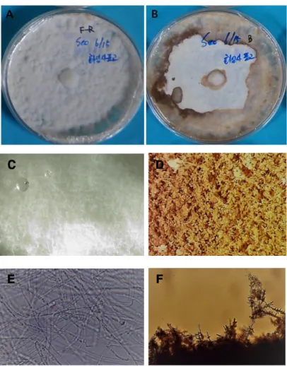 Fig. 6. White and brown mycelia of Lentinula edodes cultured under different light wavelengths