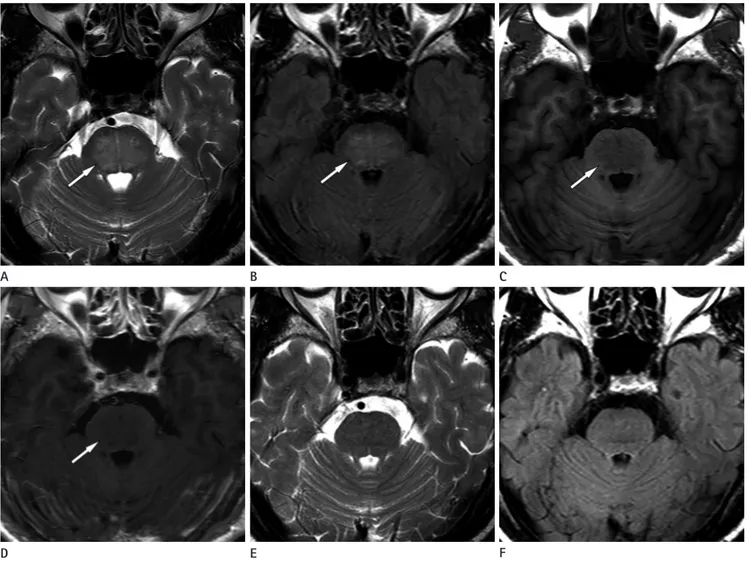 Fig. 1. A 66-year-old man presented with a 1 month history of intermittent headache. 