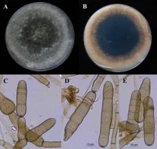 Fig. 2. Morphological features of Pyrerophora avenae. Front (A) and reverse (B) of colony on potato  dextrose agar at 25℃ for 7 days; Conidiophores with conidia (C and D); Conidia with scar (E) (scale  bars = 10 μm).