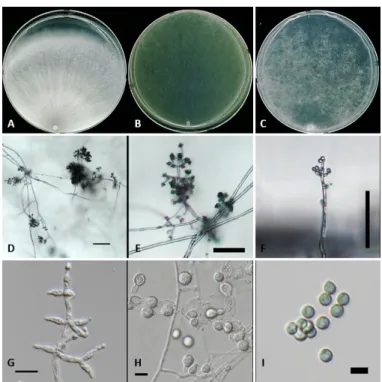 Fig. 4. Trichoderma paraviridescens NNIBRFG1772. Colony morphology on potato dextrose agar (A),  corn meal dextrose agar (B) and synthetic nitrogen-poor or nutrient-poor agar (C) after 7 days at 25℃