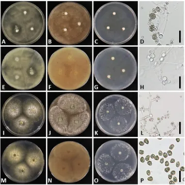 Fig. 5. Morphology of Trichoderma reesei NNIBRFG13204 (W266) (A~H) and T. saturnisporum  NNIBRFG12026 (W180) (I~P)