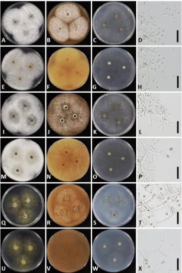Fig. 3. Morphology of Trichoderma afroharzianum NNIBRFG13201 (W281) (A~H), Trichoderma  capillare NNIBRFG13202 (W309) (I~P), and Trichoderma guizhouense NIBRFG13203 (W296)  (Q~X)