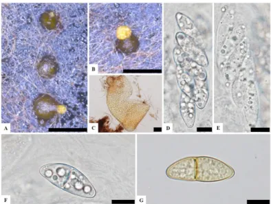 Fig. 2. Morphological characteristics of KNU16-010. A, B, Mature perithecia on potato dextrose agar; 
