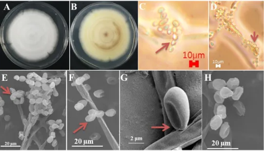 Fig. 1. Morphological characters of Nannizziopsis mirabilis KNU17-67 grown on potato dextrose  agar  for 7 days at 25°C