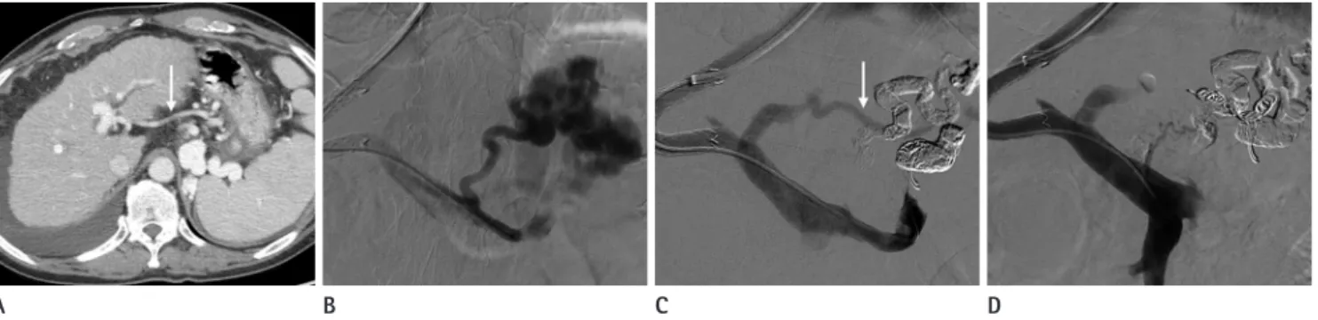 Fig. 1. A 63-year-old male with massive hematemesis. 