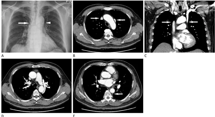 Fig. 1. A 65-year-old man with rectal cancer.