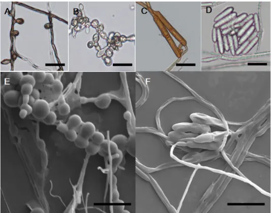 Fig. 2. Hyphae and conidiospore of strain 15P005 (Phialocephala bamuru) (A); aggregation  spore of strain 15P106 (Phialophora foetens) optical microscope image (B) and scanning  electron microscopes (SEM) image (E); macroconidia of strain 15P283 (Calonectr