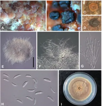 Fig. 2. Morphological and cultural features of Pilidium concavum causing tan-brown leaf spot  on strawberry