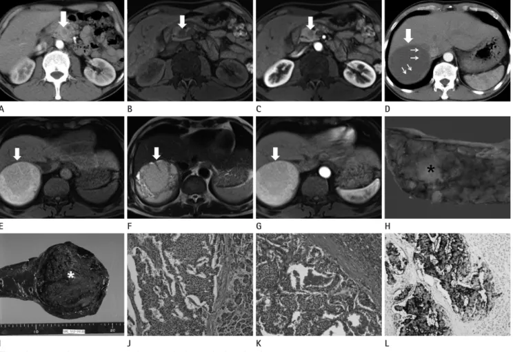 Fig. 1. A 50-year-old man presented with a week’s history of epigastric pain.